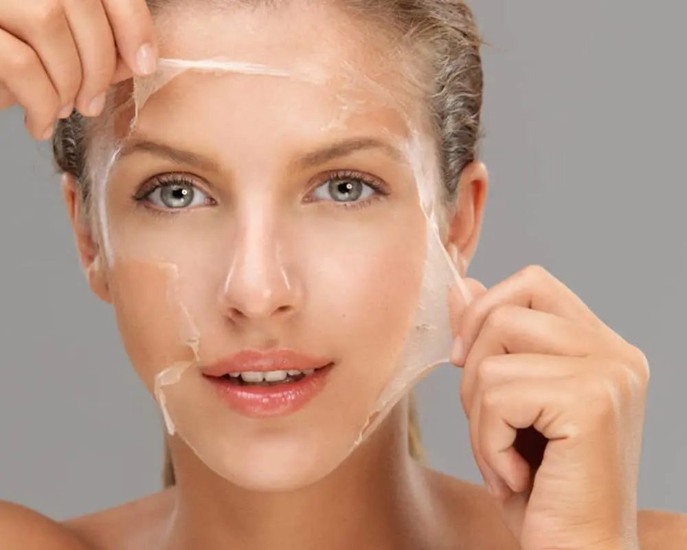 Chemical Peel Treatment for Pigmentation, Acne Scars and Skin Brightening at Korean Skin Clinic Raebareli